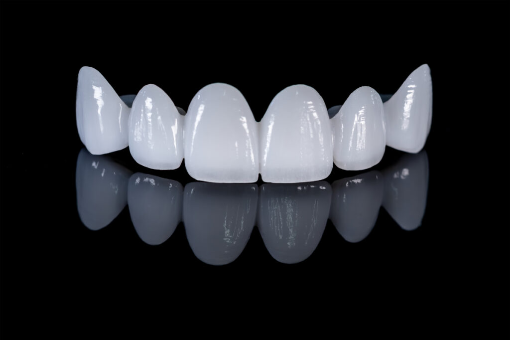 歯科技工 カラーアトラス「ザ・メタルセラミックス」変更しました 月刊「歯科技工」別冊 審美歯科技工の探求 オールセラミックス時代の多