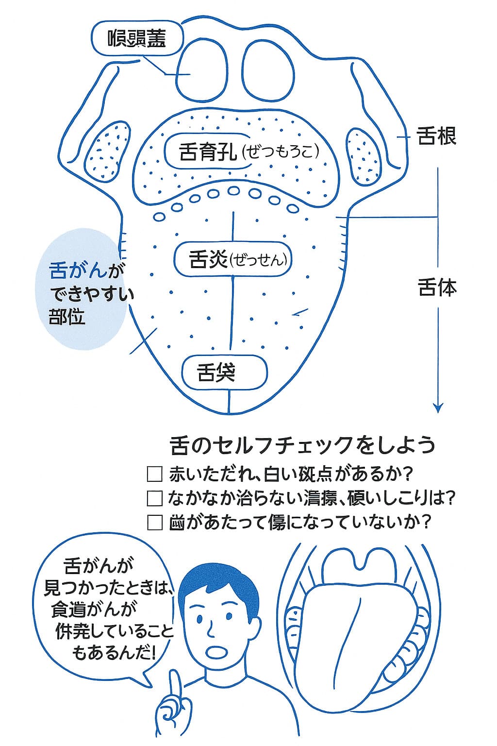 舌のセルフチェック