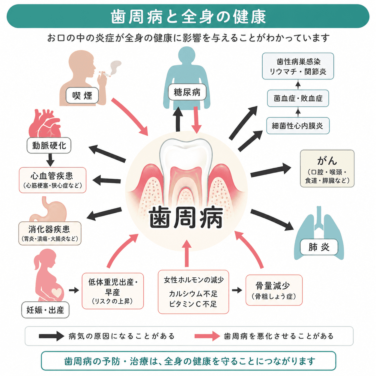 歯周病と全身の関係を表した図